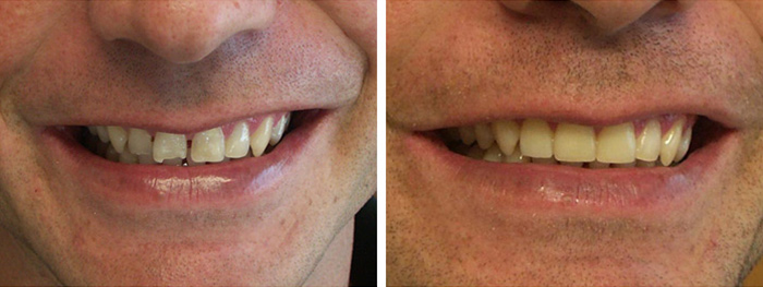 Dental Smile Gallery