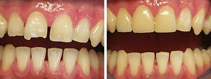 Dental Smile Gallery
