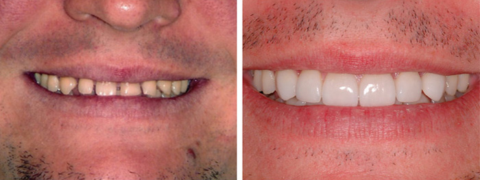 Dental Smile Gallery