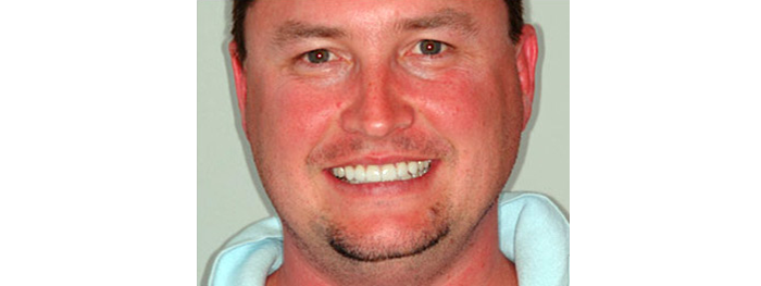 Dental Smile Gallery