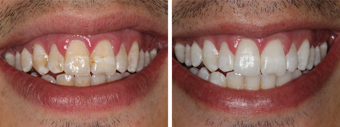 Dental Smile Gallery