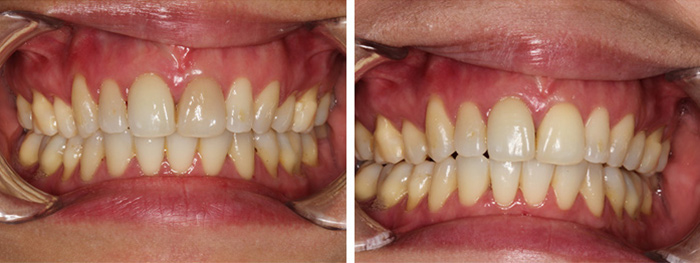 Dental Smile Gallery