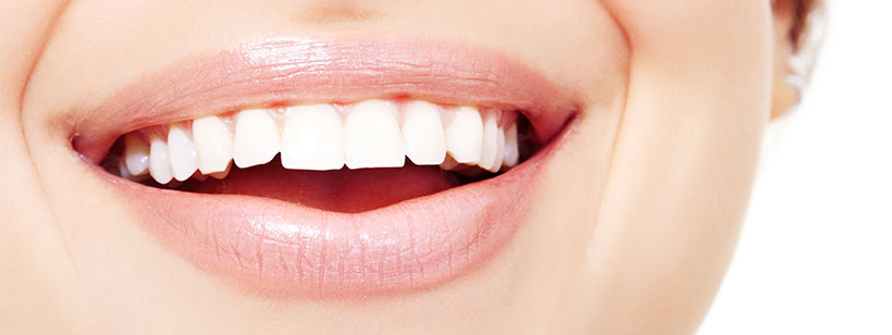 Inlays and onlays could be the answer to your tooth decay